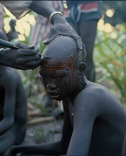 An African lad having his head scarred around with concentric circles.  There's blood dripping into his face, it looks sick af